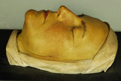 Eine Moulage mit einer durch unsachgem&auml;&szlig;e Lagerung verursachten Besch&auml;digung; (c) DH